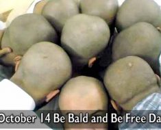 Be Bald And Free Day 2017