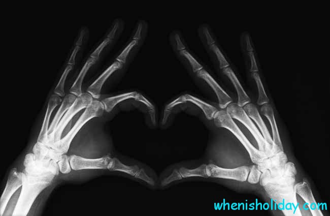 X-Ray Heart