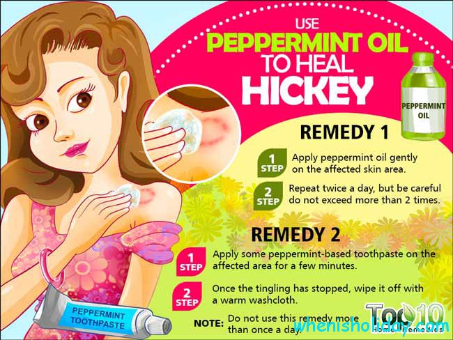 How to heal Hickey