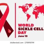 World Sickle Cell Day in [year]