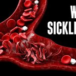 world-sickle-cell-day 9