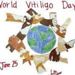 world-vitiligo-day-2