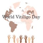 Welt-Vitiligo-Tag im Jahr 2022