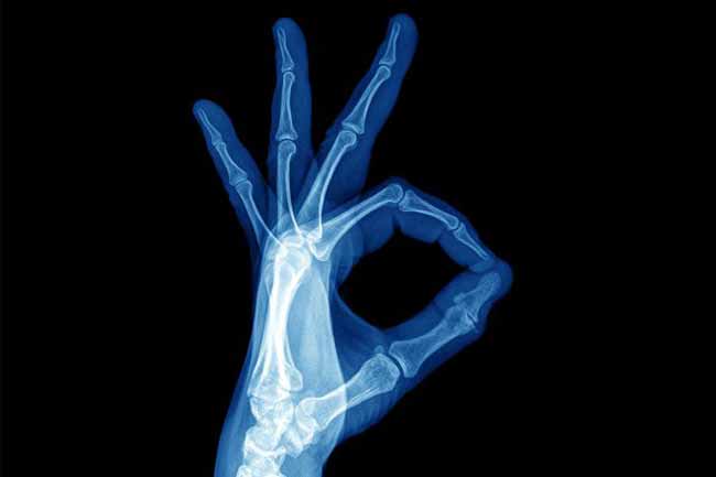 ☢️ Wann ist Internationaler Tag der Radiologie 2022