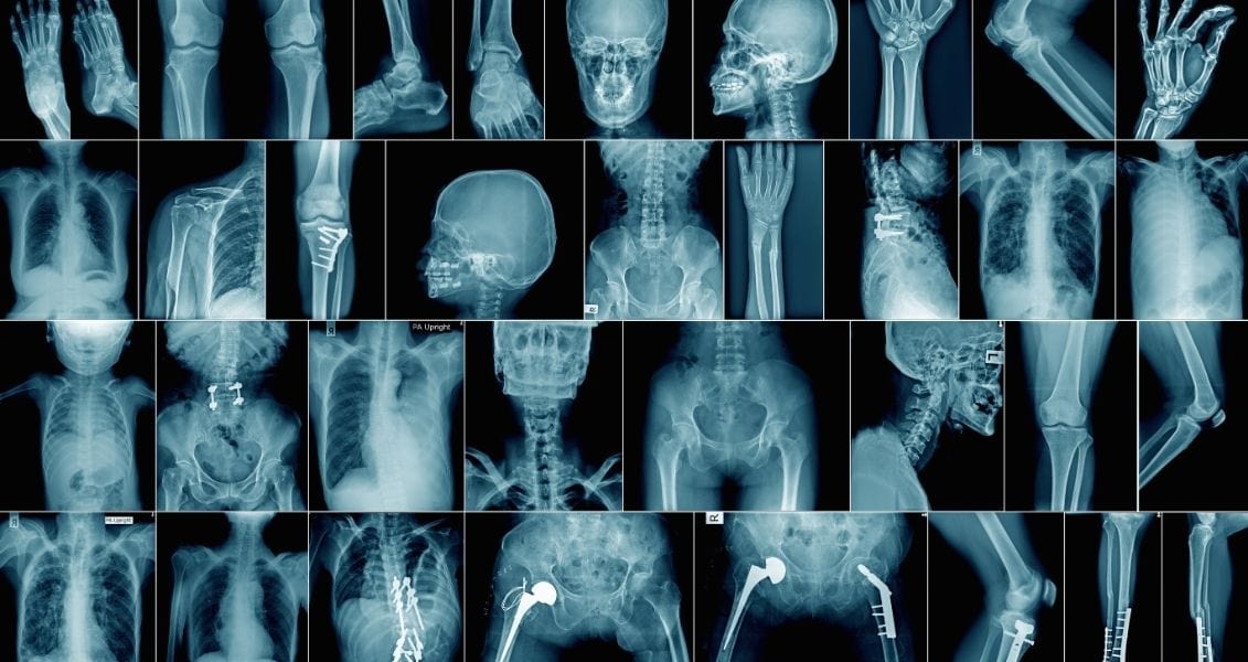 International Radiology Day and X-ray Day